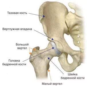 Типы протезов